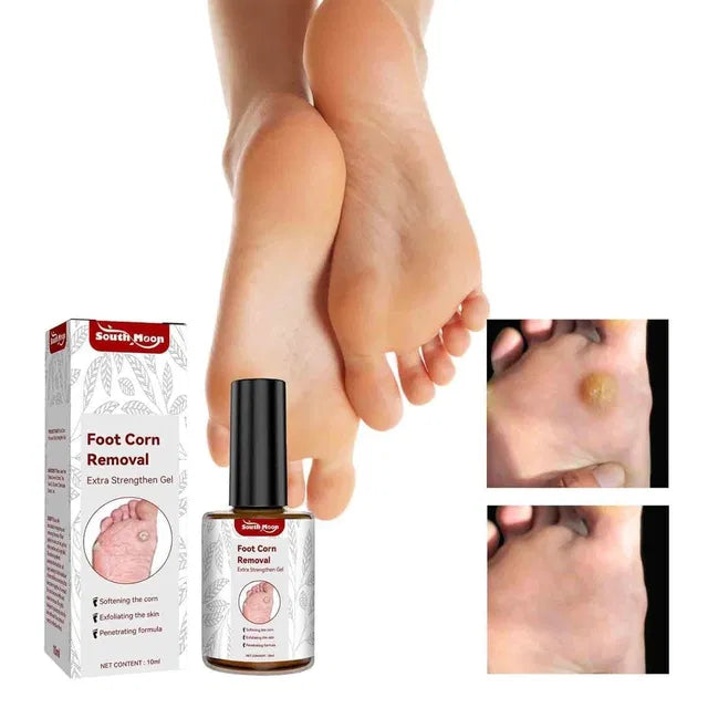 Feet Corn Removal Serum 30ml – Foot Care Serum, Pack of 1