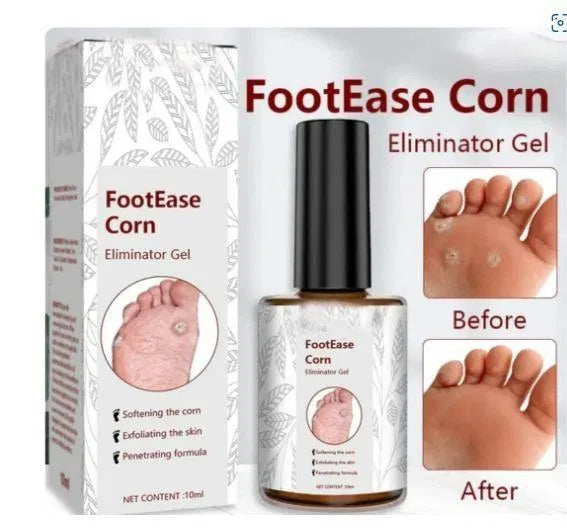 Feet Corn Removal Serum 30ml – Foot Care Serum, Pack of 1